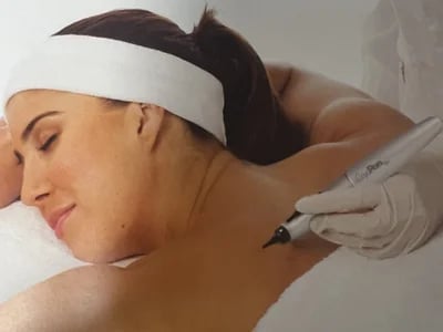 Kryotherapie Nebenwirkungen: So erkennen Sie ungewöhnliche Reaktionen