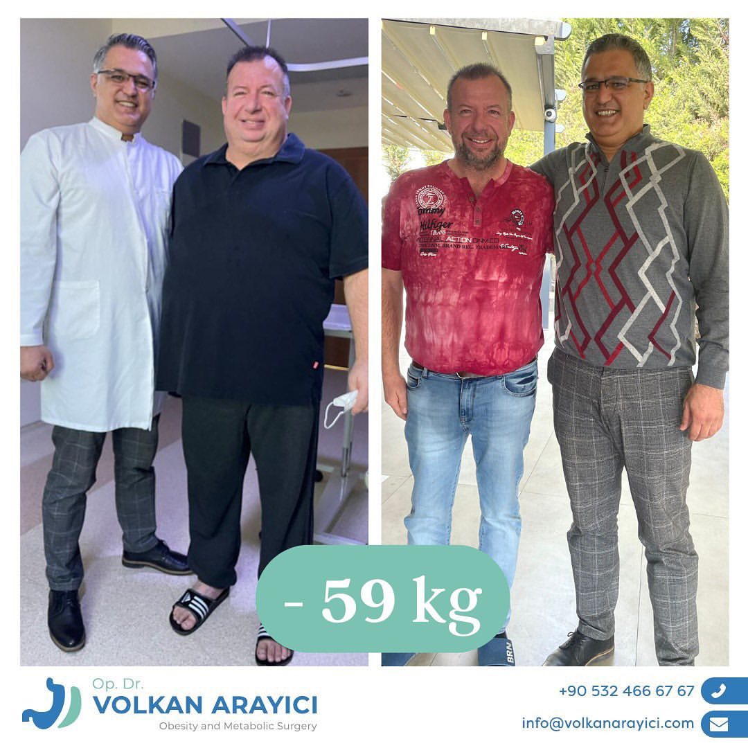 Klinikranking Türkei – wie viel kostet eine magenverkleinerung je nach Standort?